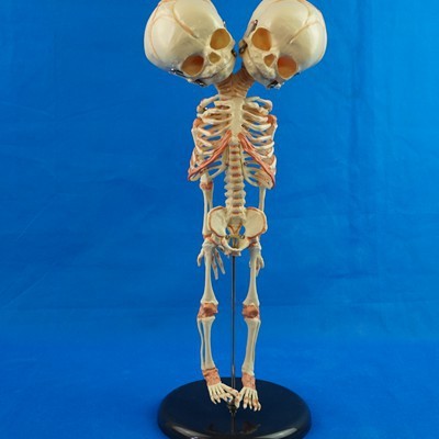 Double-headed Infant Bone Model For Medical Teaching